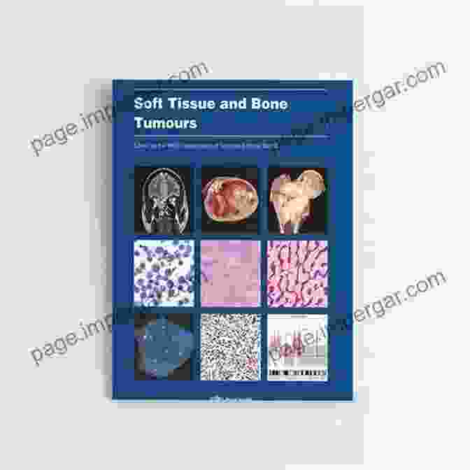 High Resolution Images Of Cytomorphological Patterns In Soft Tissue And Bone Tumors FNA Cytology Of Soft Tissue And Bone Tumors (Monographs In Clinical Cytology)